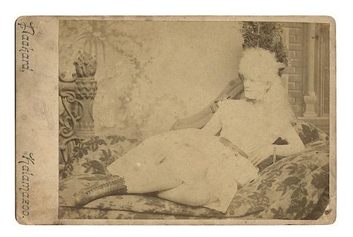 ALBINO LADY CABINET CARD.Albino
